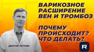 Варикозное расширение вен и тромбоз. Почему происходит? Что делать