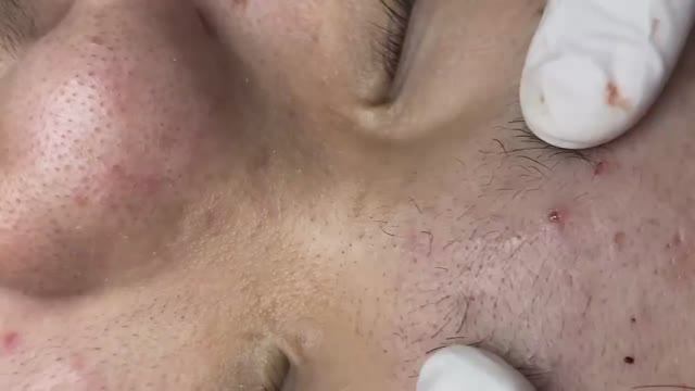 007 • Relax Spa • АСМР • Acne collection