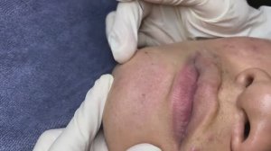 019 • Relax Spa • АСМР • Acne collection