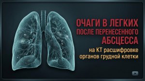 УПЛОТНЕНИЕ стенок бронхов, ОЧАГИ в легких на КТ расшифровке (второе мнение) после АБСЦЕССА легкого