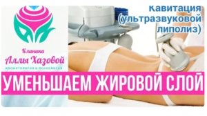 Кавитация. Метод кавитации (ультразвуковой липолиз). Как эффективно убрать жир. Как убрать живот.