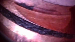 Эндоскопия Delica D:5