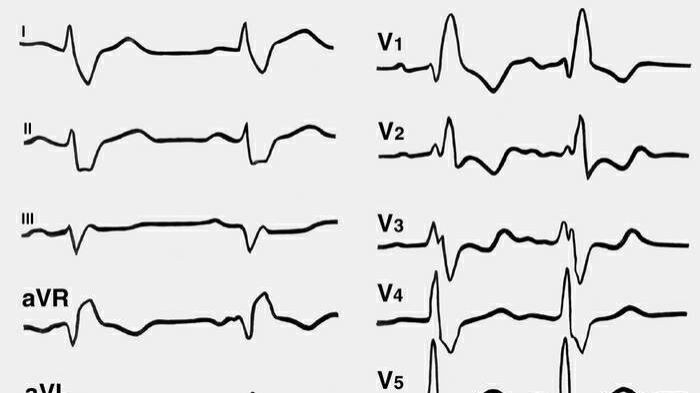 Cardiac Control&ECG