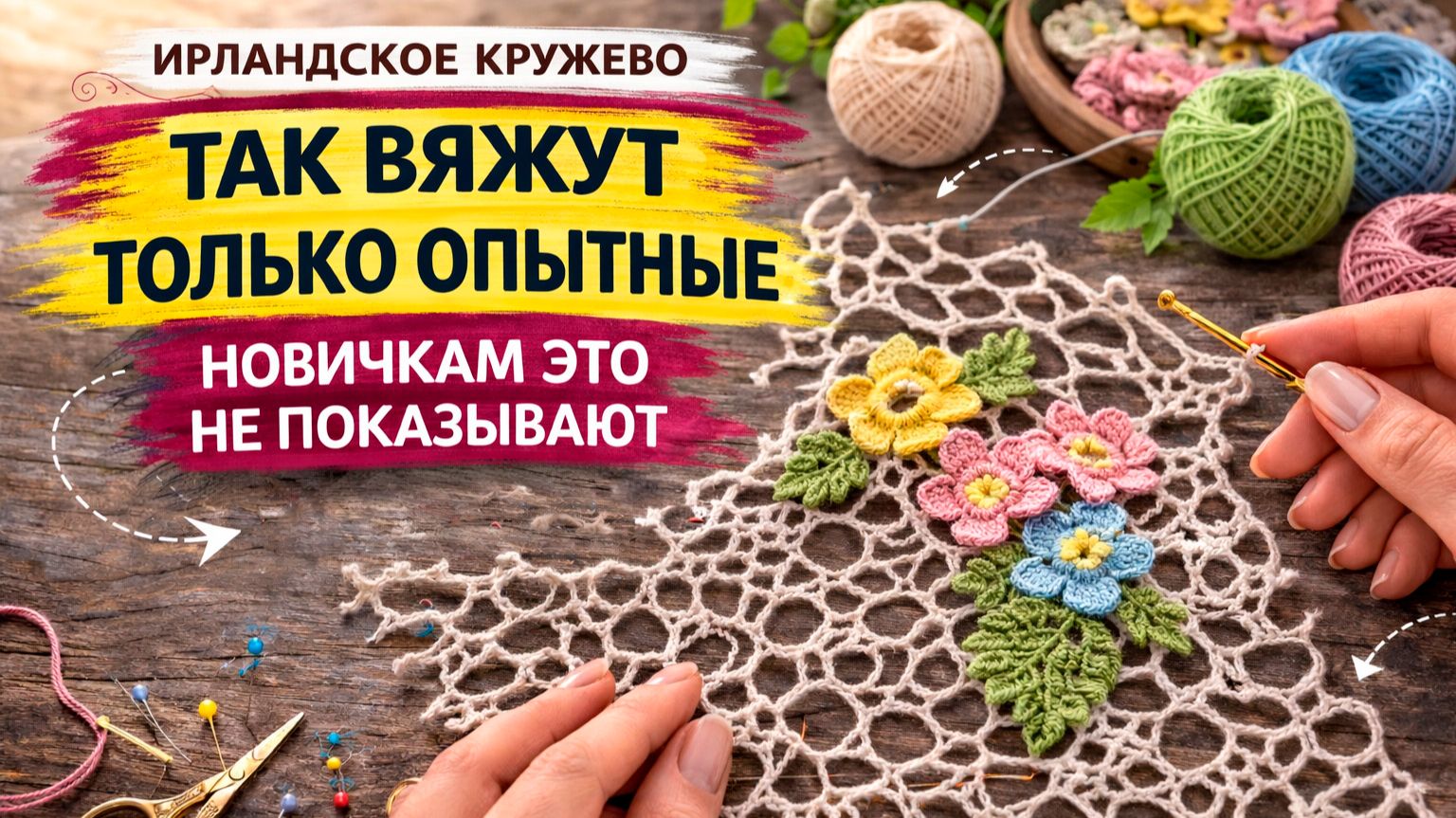 Неправильная сеточка. Часть 3 смотреть онлайн