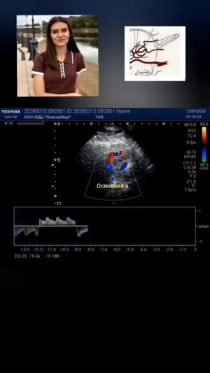 УЗДС трансокципитальное. Момонтова Юлия Андреевна.mp4