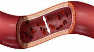 Hemodynamics_medicine_corrected