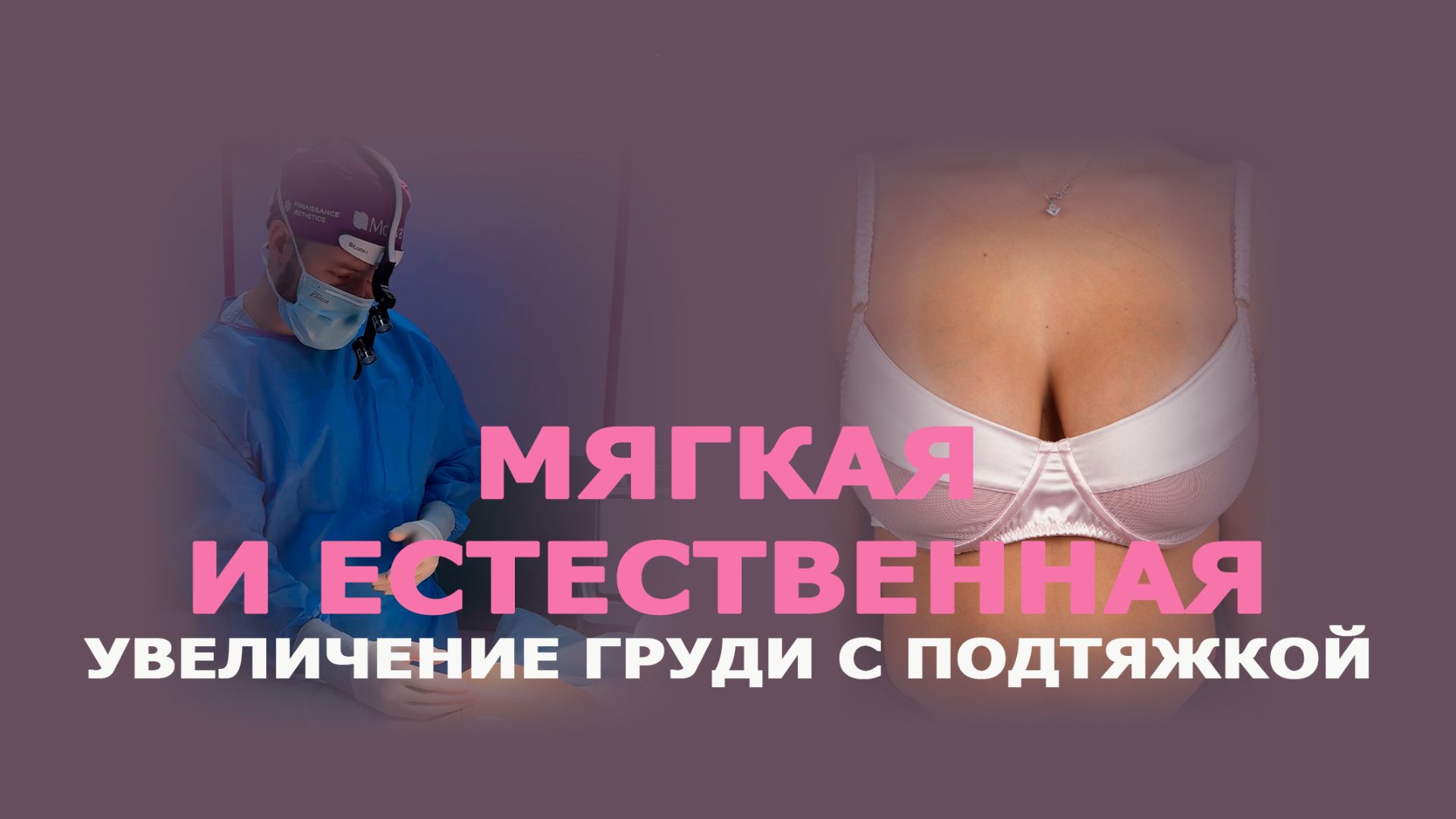 Мастопексия с имплантами: увеличение груди и подтяжка