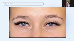 Направление в наращивании ресниц