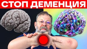 Стоп деменция!