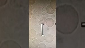 Как повысить иммунитет.