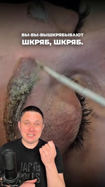 Блог про удаление ПМ и тату!  Подписывайся! #лазерноеудалениятату #перманентныймакияж #татуаж