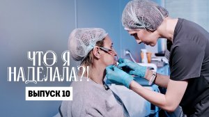 Что я наделала?! Паническая атака из-за филлера