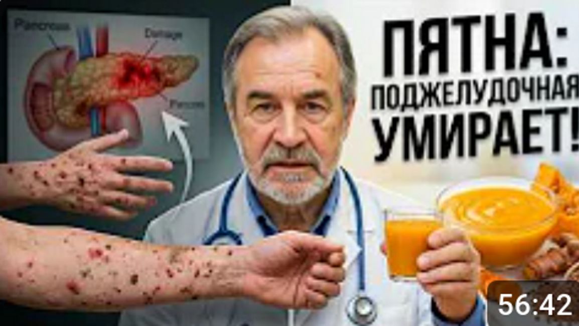 Эти пятна на коже кричат: ваша поджелудочная уже гибнет!