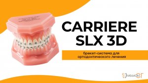 Брекет-система Carriere SLX 3D