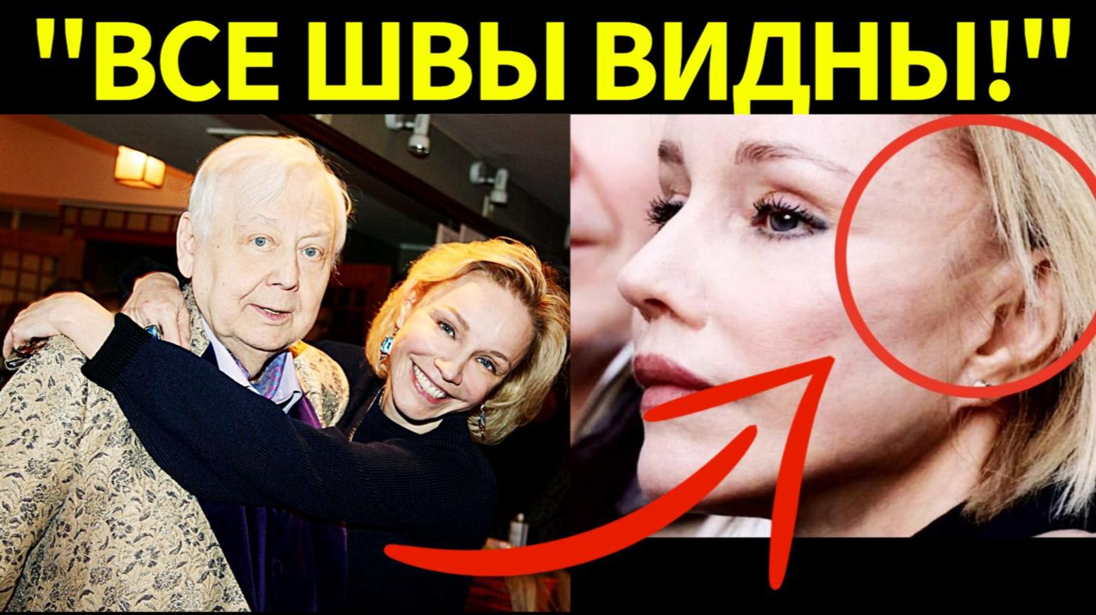 Жертва пластики! В сети активно обсуждают неудачную пластику Марины Зудиной вместо памяти Табакова