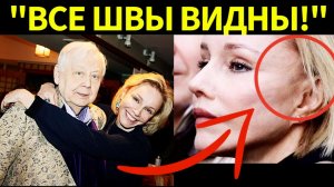 Жертва пластики! В сети активно обсуждают неудачную пластику Марины Зудиной вместо памяти Табакова