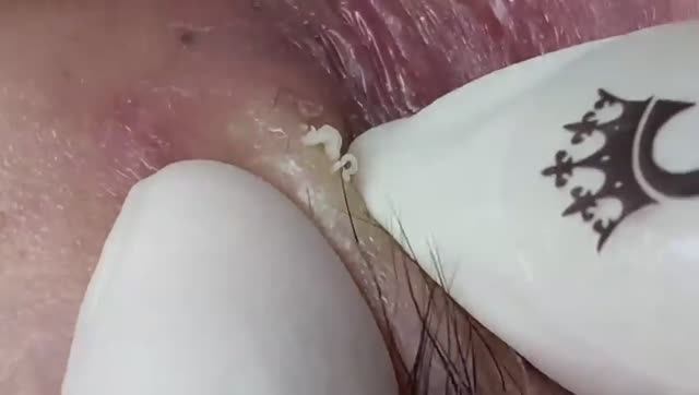 021 • Relax Spa • АСМР • Acne collection