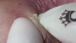 021 • Relax Spa • АСМР • Acne collection