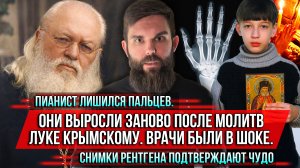 ❗️Пианист лишился пальцев. Они выросли заново после молитв Луке Крымскому. Врачи были в шоке