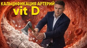 Витамин Д! Как не навредить! Кальцификация артерий, почек и суставов