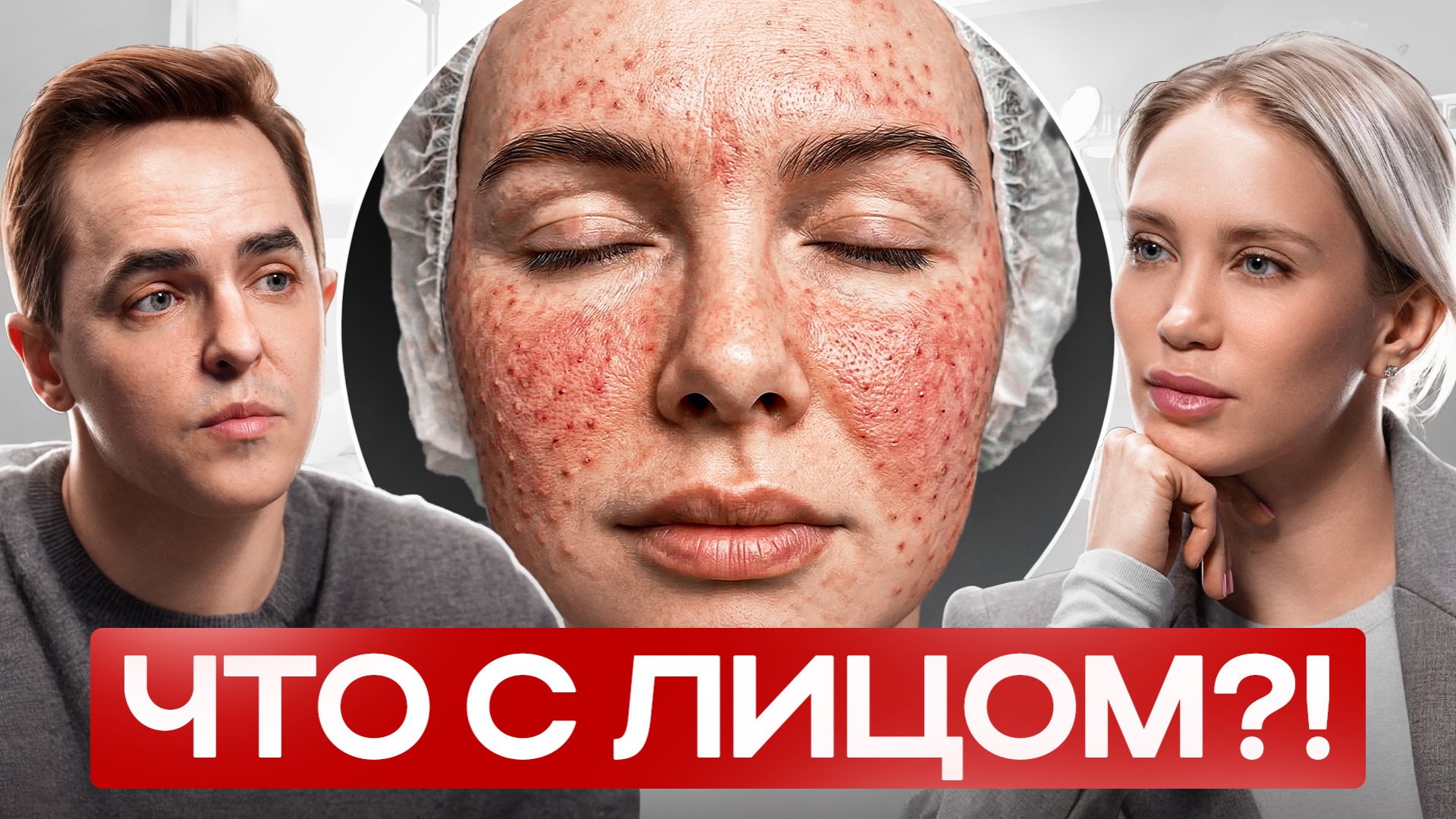 Биоревитализация: правда об уколах красоты, о которой молчат косметологи | Подкаст