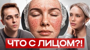 Биоревитализация: правда об уколах красоты, о которой молчат косметологи | Подкаст