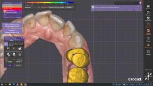 Создание конструкции под балку Blender For Dental на культях