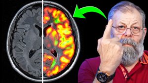 ⚡️ РИСК ИНСУЛЬТА УВЕЛИЧИВАЕТСЯ В РАЗЫ, ЕСЛИ ЕСТЬ ОДИН ИЗ 3-Х ПРИЗНАКОВ