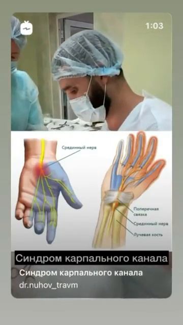 Синдром карпального канала Онемение в кисти