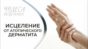 ИСЦЕЛЕНИЕ ОТ АТОПИЧЕСКОГО ДЕРМАТИТА. «Чудеса исцеления»