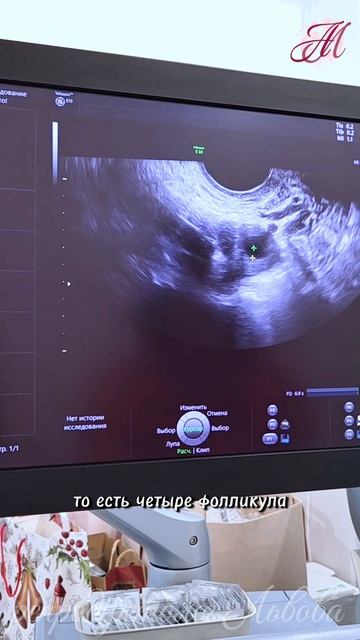 Мониторинг в 44 года