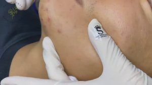 012 • Relax Spa • АСМР • Acne collection