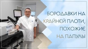 😲 Бородавки на крайней плоти, похожие на папулы. Клинический случай №75
