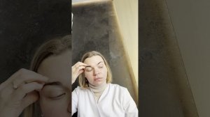 Лечение розацеа Консультация 18 февраля 2026. Дерматолог Перевалова Елена Геннадьевна 0746