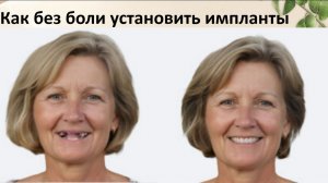 Как без обезболивающих и антибиотиков поставить имплант зуба.