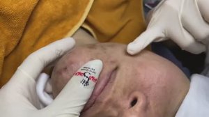 024 • Relax Spa • АСМР • Acne collection