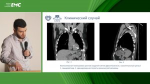 5. Гурциев М.Х., Тетерин Ю.С., Ярцев П.А. Новые технологии в ликвидации патологического соустья ЖКТ