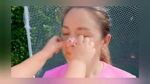 Диана и Рома что делать при ушибах