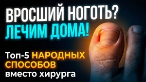 Вросший ноготь без операции: 5 простых народных средств, которые реально работают