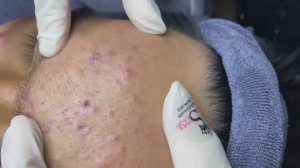 026 • Relax Spa • АСМР • Acne collection