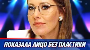 Ксения Собчак показала своё лицо без пластики 🔥 Новости Шоу Бизнеса