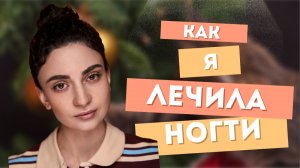 КАК Я ВЫЛЕЧИЛА СВОИ НОГТИ
