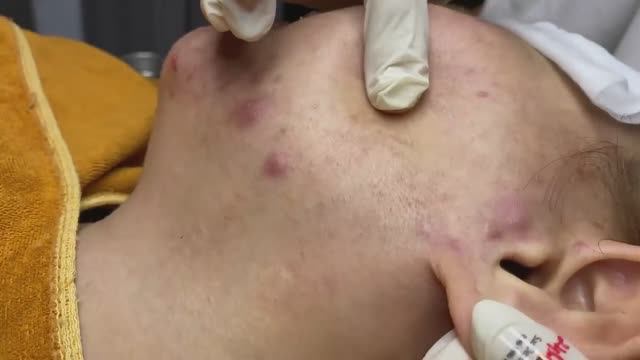 025 • Relax Spa • АСМР • Acne collection