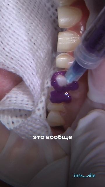 Не всё «современное» в стоматологии действительно стоит своих денег 👇