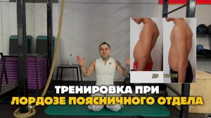 ТРЕНИРОВКА ПРИ ЛОРДОЗЕ ПОЯСНИЧНОГО ОТДЕЛА 🔥