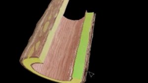 Tunica media — средняя оболочка артериальных сосудов