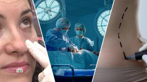 Опасные тренды: на какие жертвы идут женщины в погоне за красотой | «Центральное телевидение»