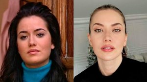 ТОП 20 Турецких Актрис До и После Пластической Операции