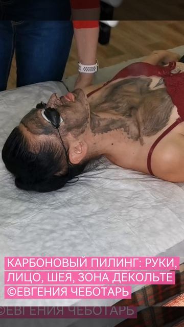 РАБОЧИЙ ПРОЦЕСС — КАРБОНОВЫЙ ПИЛИНГ КОМПЛЕКС: РУКИ, ЛИЦО, ШЕЯ, ЗОНА ДЕКОЛЬТЕ | КОРРЕКЦИЯ ЛИЦА И ТЕЛА