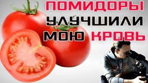 Помидоры улучшили мою кровь под микроскопом | Воспаления не обнаружено.